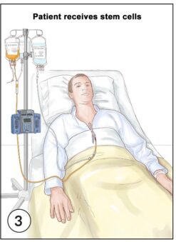 Stem cells