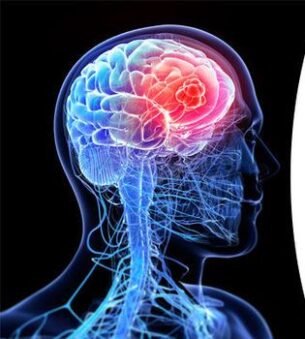 Brain cancer treatment in Iran