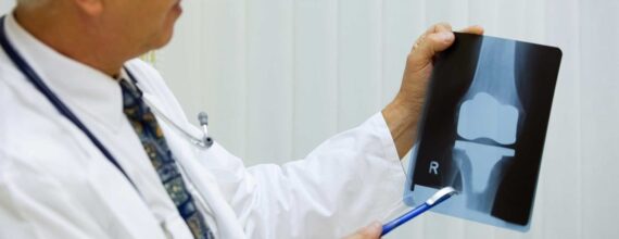 Knee Replacement in Iran