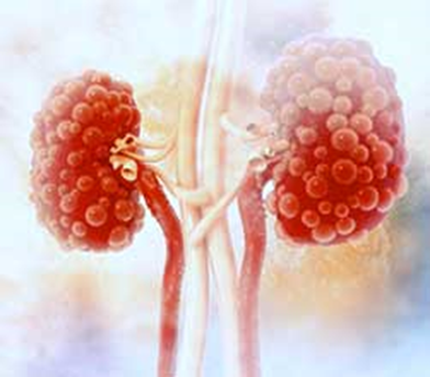 Polycystic Kidney Disease