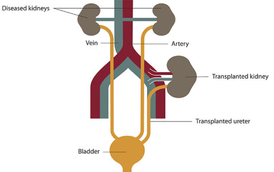 kidney function kidney transplant