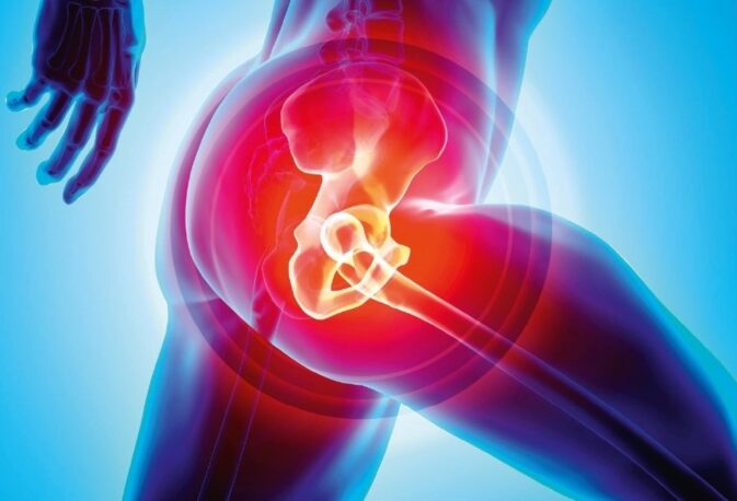 Hip joint Replacement surgery