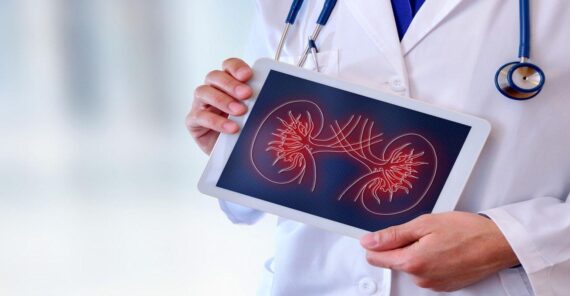 Kidney Transplant in Iran