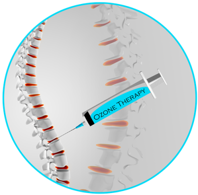 Ozone therapy in Iran