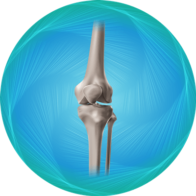 Knee Replacement Package