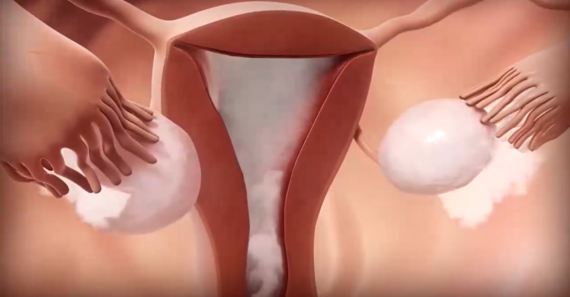 fertility treatment