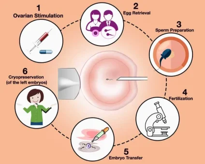 the details of ICSI procedure
